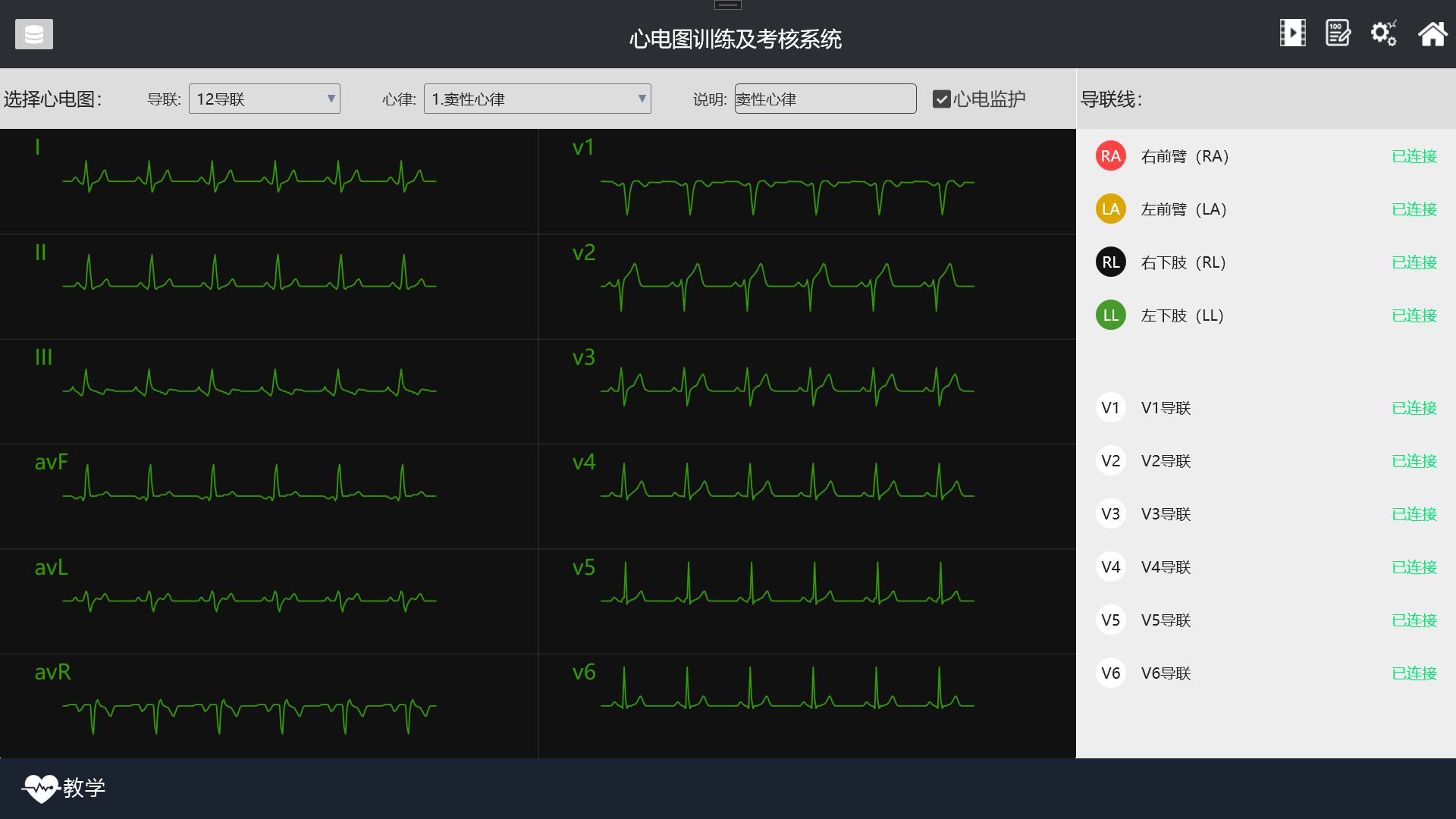 MN213心电图教学软件